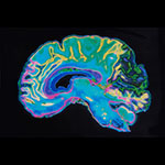 image of a brain scan