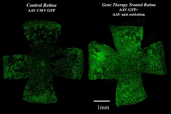 Gene Therapy to Combat Oxidation Can Prolong Cone Survival