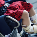 a child with cerebral palsy in a wheelchair