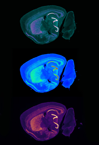 3D microscopy of the brain revealing the spatial distribution of an essential neuronal protein, CTIP2