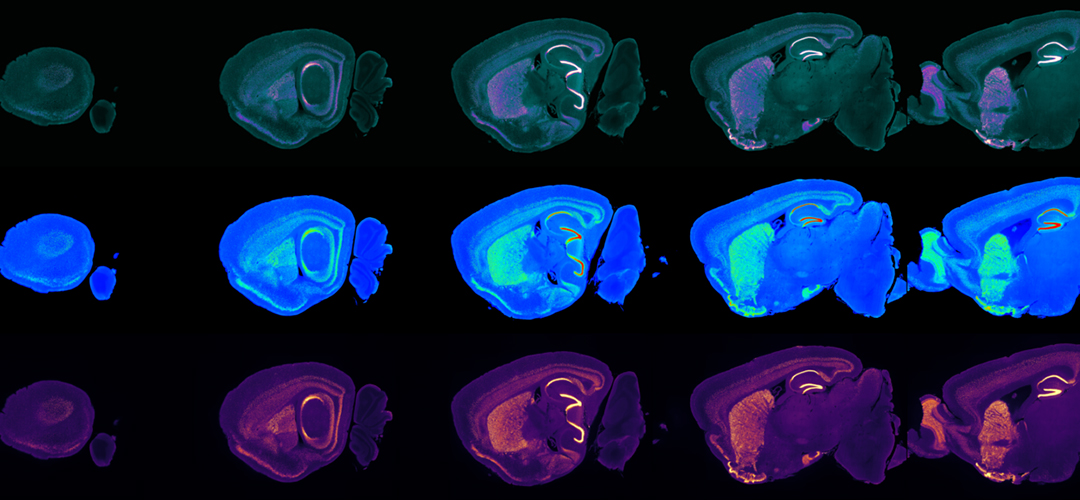 3D microscopy of the brain revealing the spatial distribution of an essential neuronal protein, CTIP2