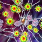 illustration of neurons being attached by viruses