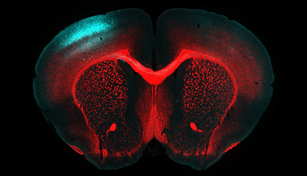 cross-section of the brain from a young mouse.