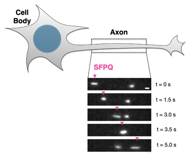 Real time imaging of SFPQ in axons of sensory neurons. SPFQ moves in both directions. Kinesin-mediated transport is shown with pink arrowhead
