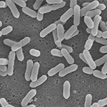 Hormone-generating Eggerthella lenta bacteria seen under a scanning electron microscope