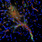 Inflammed spinal cord in mouse with ALS mutation