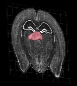 A coronal section of the mouse brain highlighting the location of the habenula