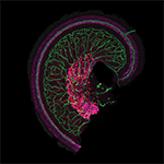 Hair cells, shown in magenta, in the snail-shaped cochlea of the inner ear.