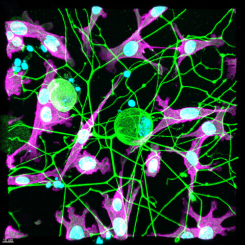 Nociceptors and Cancer Cells by Pavel Hanc