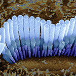 A scanning electron microscope image of a hair bundle protruding from a sensory cell in the inner ear. )
