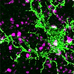 A microglia cell (shown in green) and corticostriatal synapses (purple) from a patient with Huntington’s disease. Image: Dan Wilton