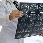 a doctor holding an MRI image