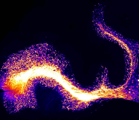 Flaming Cerebellar Cortex by Olga Alekseyenko