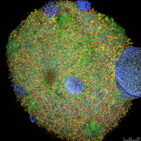 Human iPSC-Derived Spinal Spheroid by Keunjung Heo