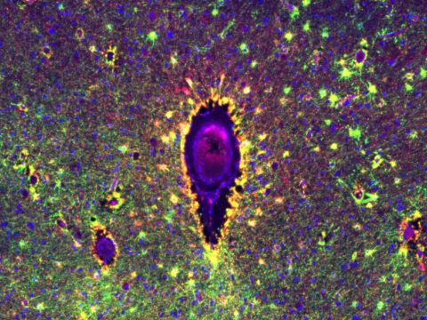 Brain Teardrops by Methasit Jaisa-Aad