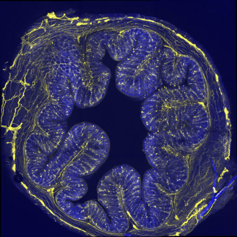 The Brain in the Gut by Valentina Lagomarsino