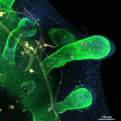 Hair Follicle With Touch Receptor Cells by Ahn Phuong Le