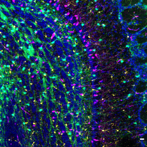 Glial Diversity in the Olfactory Bulb by Anoohya Muppirala