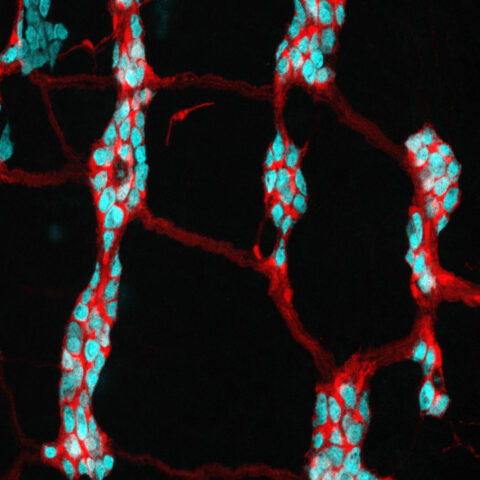 Genetically Labeled Tapestry: Coloring the Brain Net of the Gut by Anoohya Muppirala