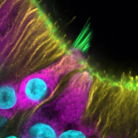 Stem Cell-Derived Human Hair Cell of the Inner Ear by Carl Nist-Lund