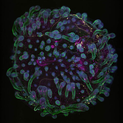 Skin Organoid Generated From iPSC with Innervated Neurons by Ahn Phuong Le