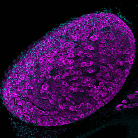 Sympathetic Ganglion Neurons by Katelyn C. Boulanger