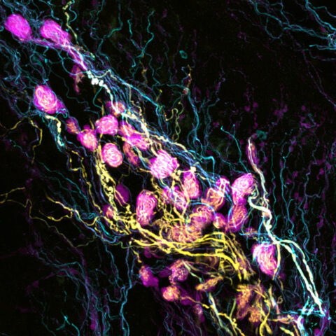 Krause Corpuscles in the Mouse Clitoris by Lijun Qi
