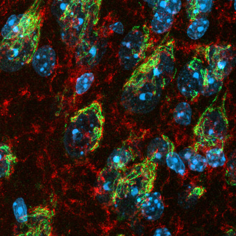 Rare Perspectives on Rare Diseases by Marlene Scheffold