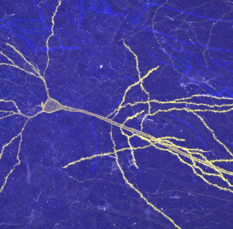 Spiny Night: A Neuron Illuminated by Maryse Thomas