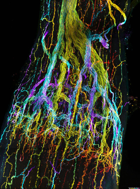 Motor Neurons Innervating Eye Muscles by Sampath Vemula