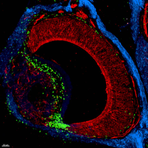 The Murine Vomeronasal Organ and Immunity by Rodrigo Gonzalez