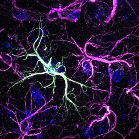Astrocyte Waltz by Molly Healey