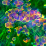 Pain-sensing neurons are stained green and red to show activity under a microscope. Image: Tao Deng/NCATS Stem Cell Translation Laboratory/NIH