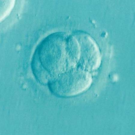 an image of an embryo