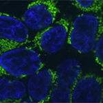 A microscope image showing the mitochondrial protein frataxin (green) in human cells. Frataxin is lacking in patients with Friedreich’s ataxia. Image: Tslil Ast
