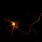 A neuron engineered by the Macklis Lab shows the cell body extending a long axon. Image: Ozkan Padmanabhan
