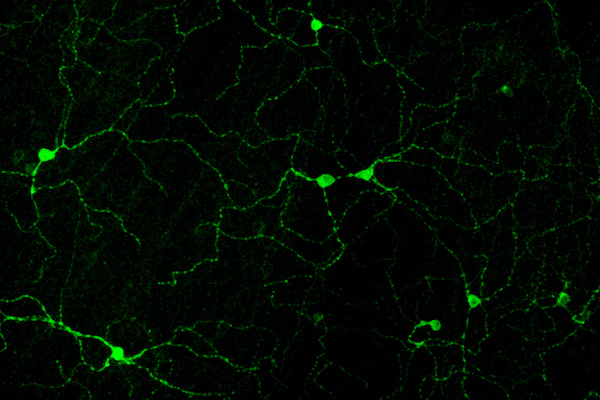melanopsin-cells-milner-and-do-2017-green-only-copy