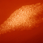 Photomic: Clostridium botulinum type A colony on 72 hour blood agar plate (5X).