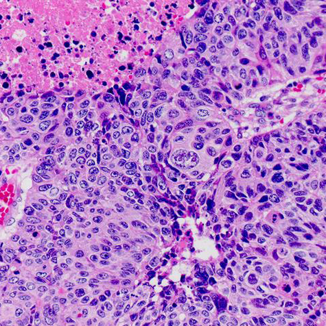 neuroendocrine