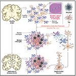 The figure illustrates schematically a working model of how age-related accumulation of cancer driver mutations occurs with normal aging (purple microglial cells), but can be accelerated in its effects by the inflammatory effects of amyloid and tau proteins in AD, causing mutant microglia to out-compete the normal microglia (blue) for survival. Mutant microglia activate inflammatory and secretory pathways that have been shown to be toxic to non-mutant microglia, as well as to neurons, potentially contributing to neuronal degeneration. Figure taken from Huang et al, (2026).