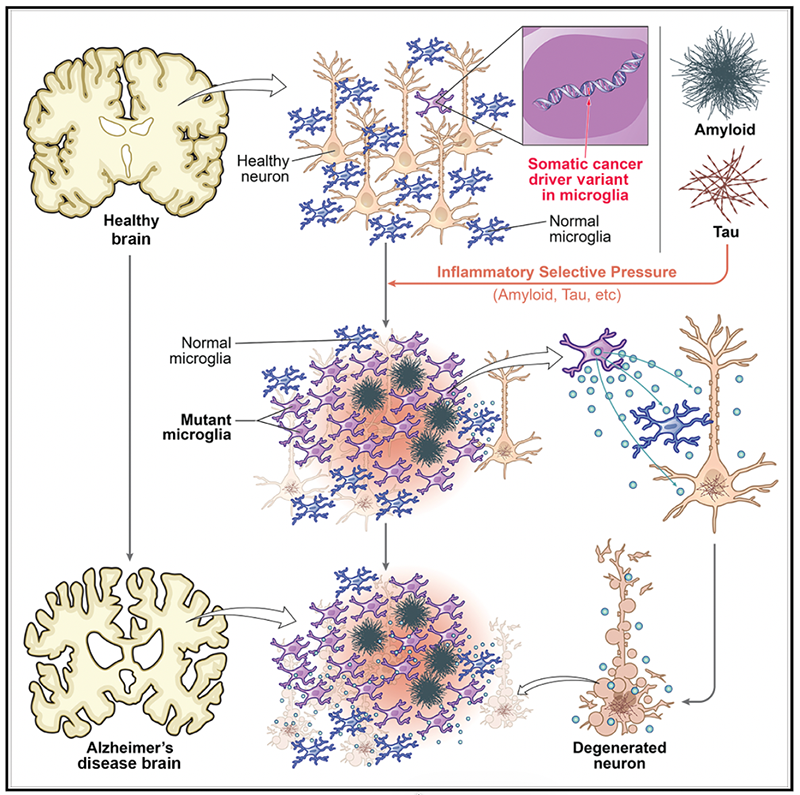 The figure illustrates schematically a working model of how age-related accumulation of cancer driver mutations occurs with normal aging (purple microglial cells), but can be accelerated in its effects by the inflammatory effects of amyloid and tau proteins in AD, causing mutant microglia to out-compete the normal microglia (blue) for survival. Mutant microglia activate inflammatory and secretory pathways that have been shown to be toxic to non-mutant microglia, as well as to neurons, potentially contributing to neuronal degeneration. Figure taken from Huang et al, (2026).
