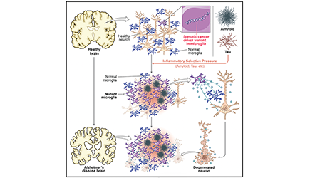 The figure illustrates schematically a working model of how age-related accumulation of cancer driver mutations occurs with normal aging (purple microglial cells), but can be accelerated in its effects by the inflammatory effects of amyloid and tau proteins in AD, causing mutant microglia to out-compete the normal microglia (blue) for survival. Mutant microglia activate inflammatory and secretory pathways that have been shown to be toxic to non-mutant microglia, as well as to neurons, potentially contributing to neuronal degeneration. Figure taken from Huang et al, (2026).