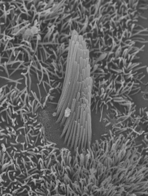 Stairway to Heaven: The Bundle of a Human Stem-Cell Derived Hair Cell by Carl Nist-Lund