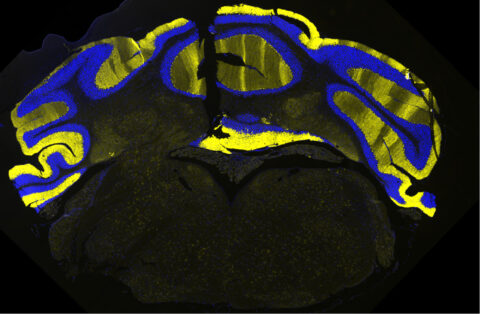 Unique Distribution of N-Glycans in the Brain by Maxence Noel