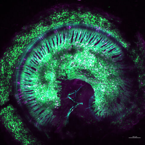 Non-Neuronal Network in the Developing Cochlea by Olubusola Olukoya.