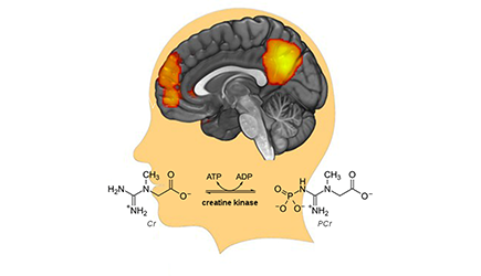 illustration showing nodes of a large-scale brain network