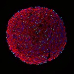 Microscopy image of a skeletal muscle organoid. The green cells are in vitro-derived satellite cells.