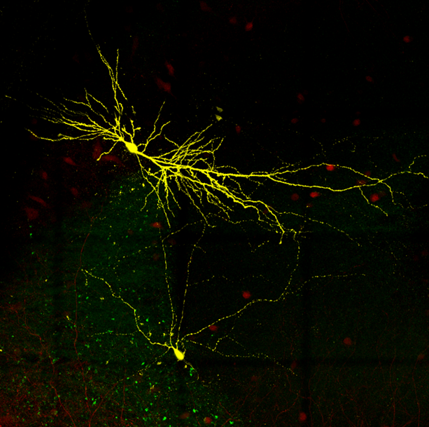Parvalbumin interneuron and pyramidal cell in hippocampal CA2