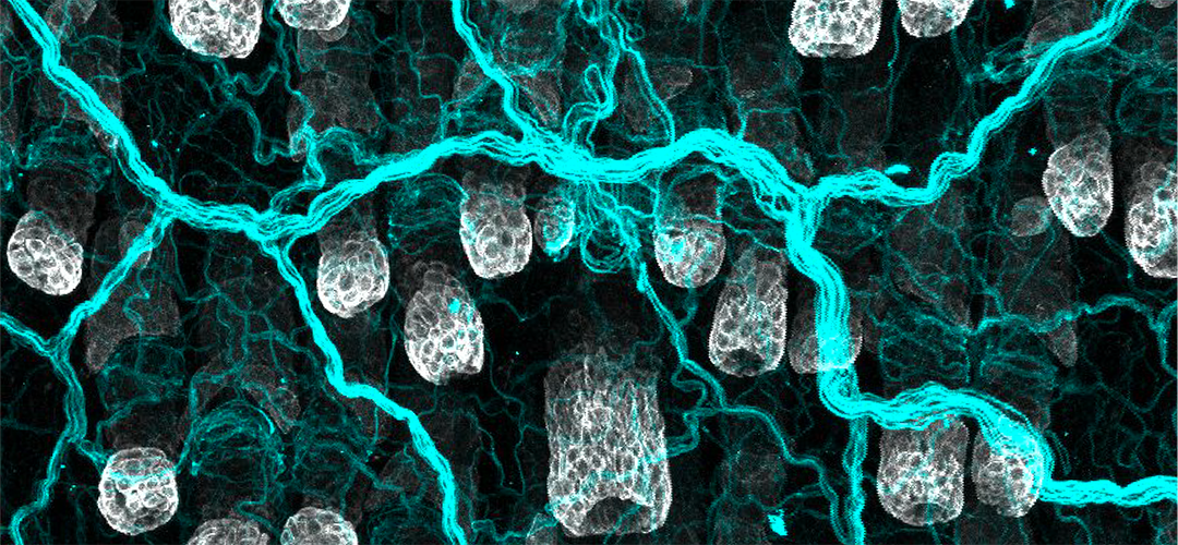 Image depicting the intricate network of sensory neurons (blue) that innervate the skin epidermis and hair follicles (white), enabling us to perceive touch, temperature, and pain—crucial functions for adapting to a constantly changing environment.