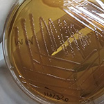 Morganella morganii bacteria on a plate.